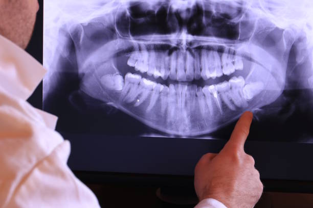 Best Emergency TMJ Treatment in Hartshorne, OK