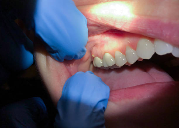 Best 24-Hour Emergency Dentist in Hartshorne, OK